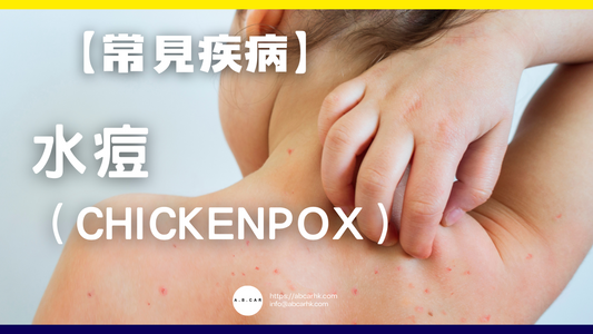 【常見疾病】水痘(Chickenpox)