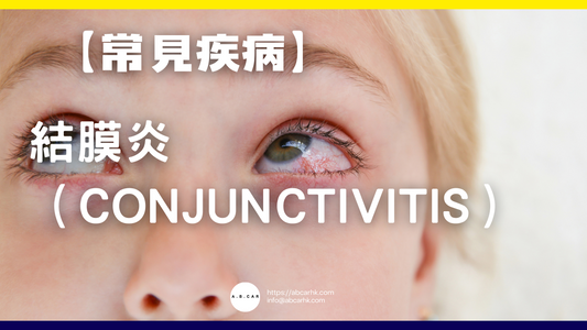 【常見疾病】結膜炎(Conjunctivitis)