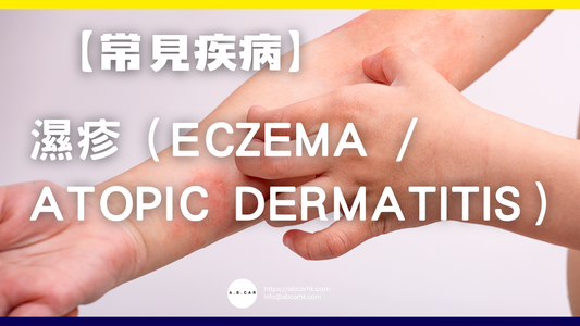 【常見疾病】濕疹(Eczema / Atopic Dermatitis)