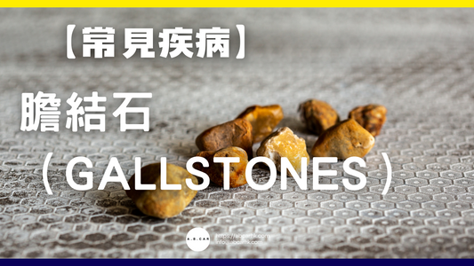 【常見疾病】膽結石(Gallstones)