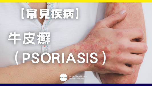 【常見疾病】牛皮癬(Psoriasis)